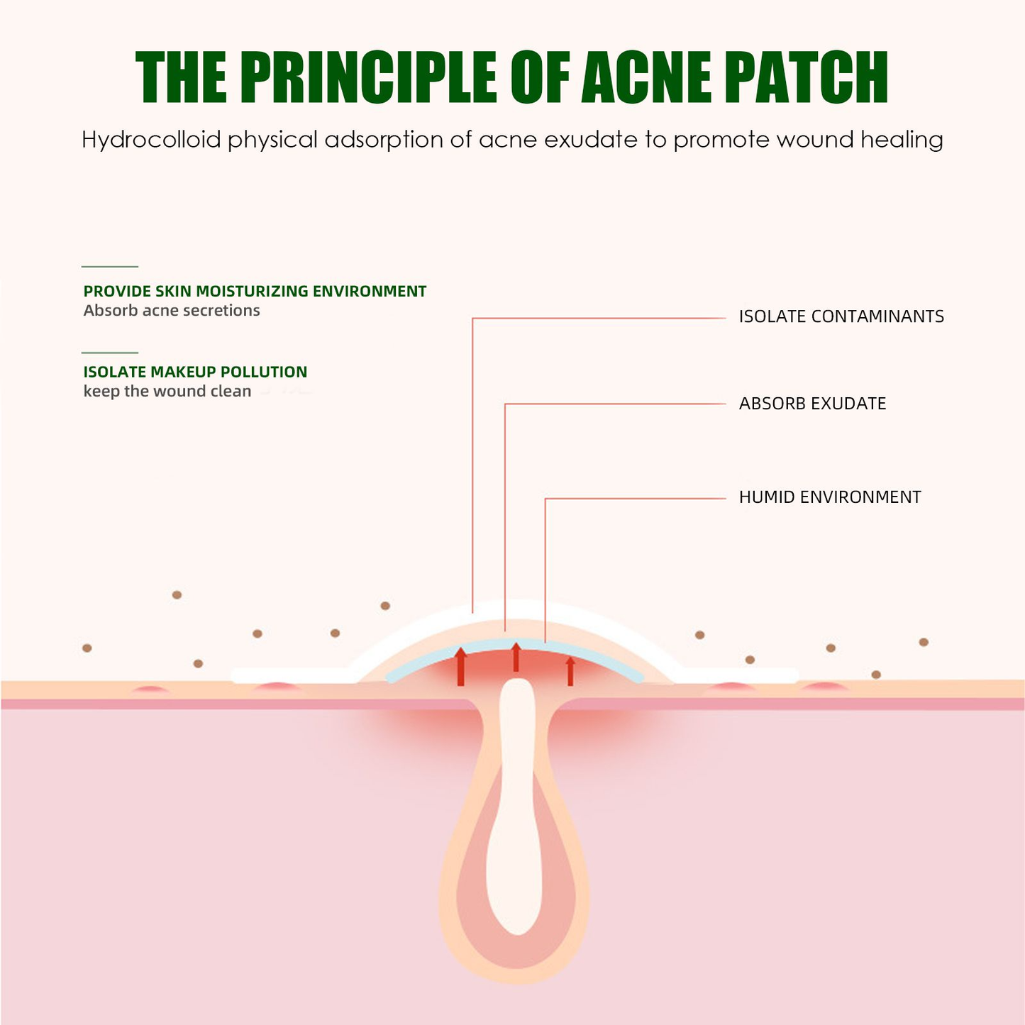 pimple patches - get rid of that shit